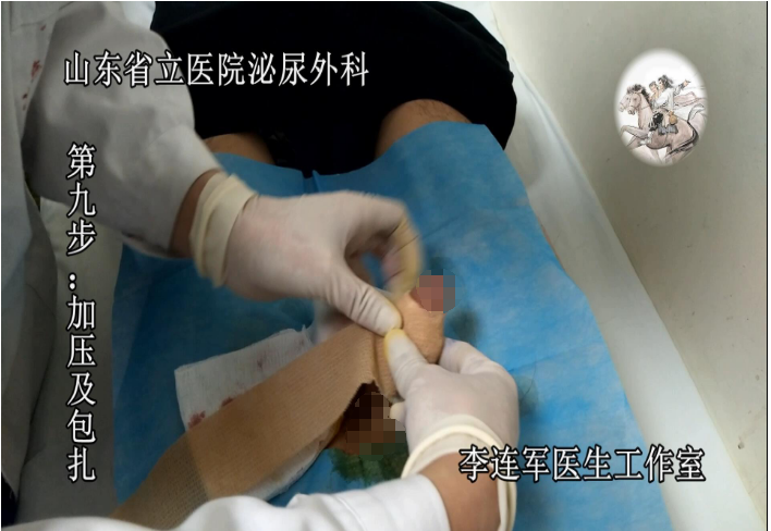 想要做手术的患者可以参考以上的图片步骤,大体就是这个情况,这样就