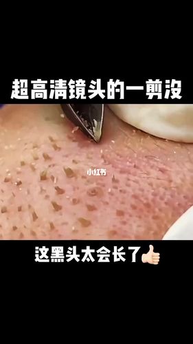 超过瘾拔黑头_解压_解压视频_美妆_护肤_护肤其他