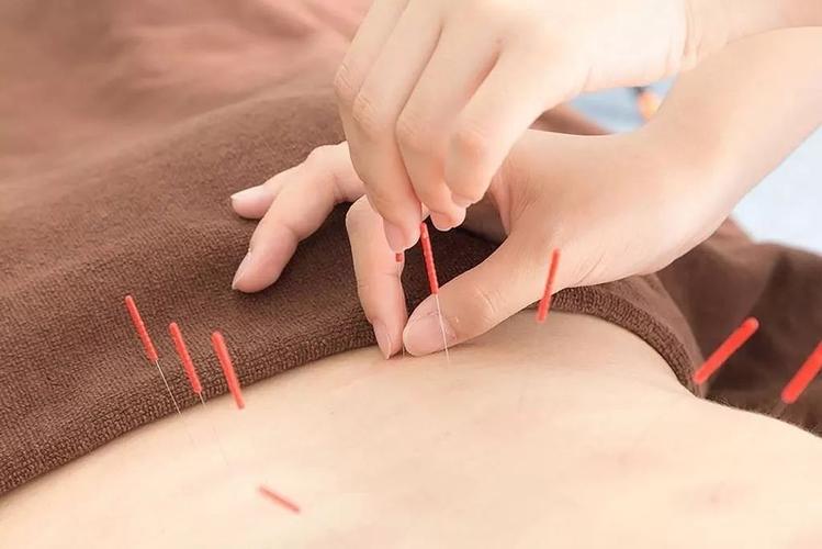 想学会针灸,这几步你得弄清楚