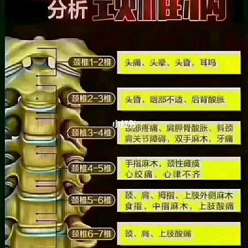 人的颈椎分为七节 七节所控制的身体部位95 颈椎1-2椎:头痛 头晕