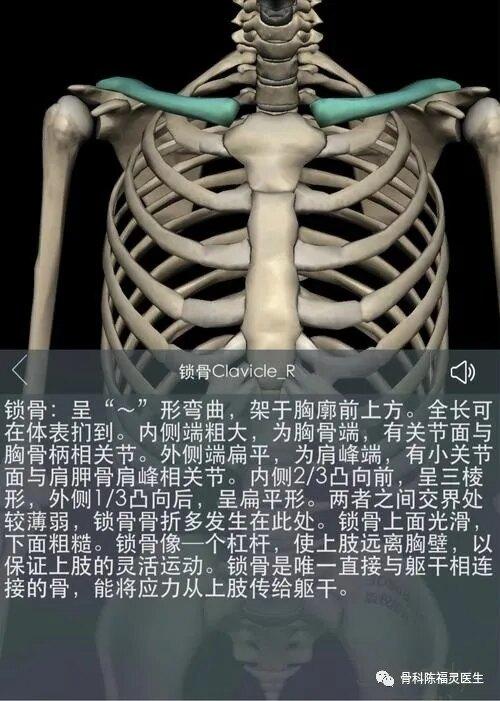 锁骨骨折的微创治疗