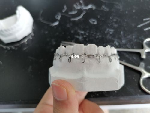 第一次牙弓夹板制作圆满完成!撒花撒花~_夹板_医学生