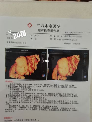 24周宝贝四维彩超新鲜出炉_四维彩超_胎儿_孕期_母婴