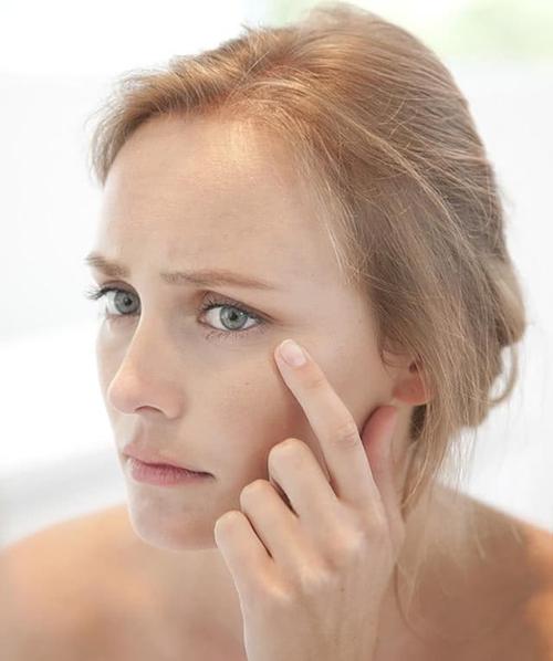 怎样才能不受眼部干纹,细纹困扰?