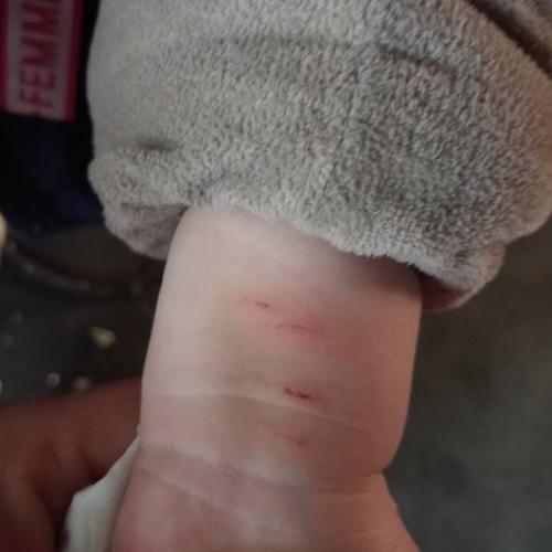 请问,这是被小狗抓伤的吗?