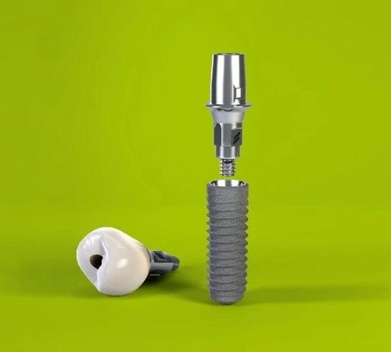 郑州瑞士iti种植牙医生刘成龙:下颌多颗种植案例