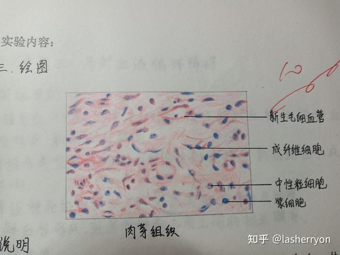 病理红蓝铅笔手绘图
