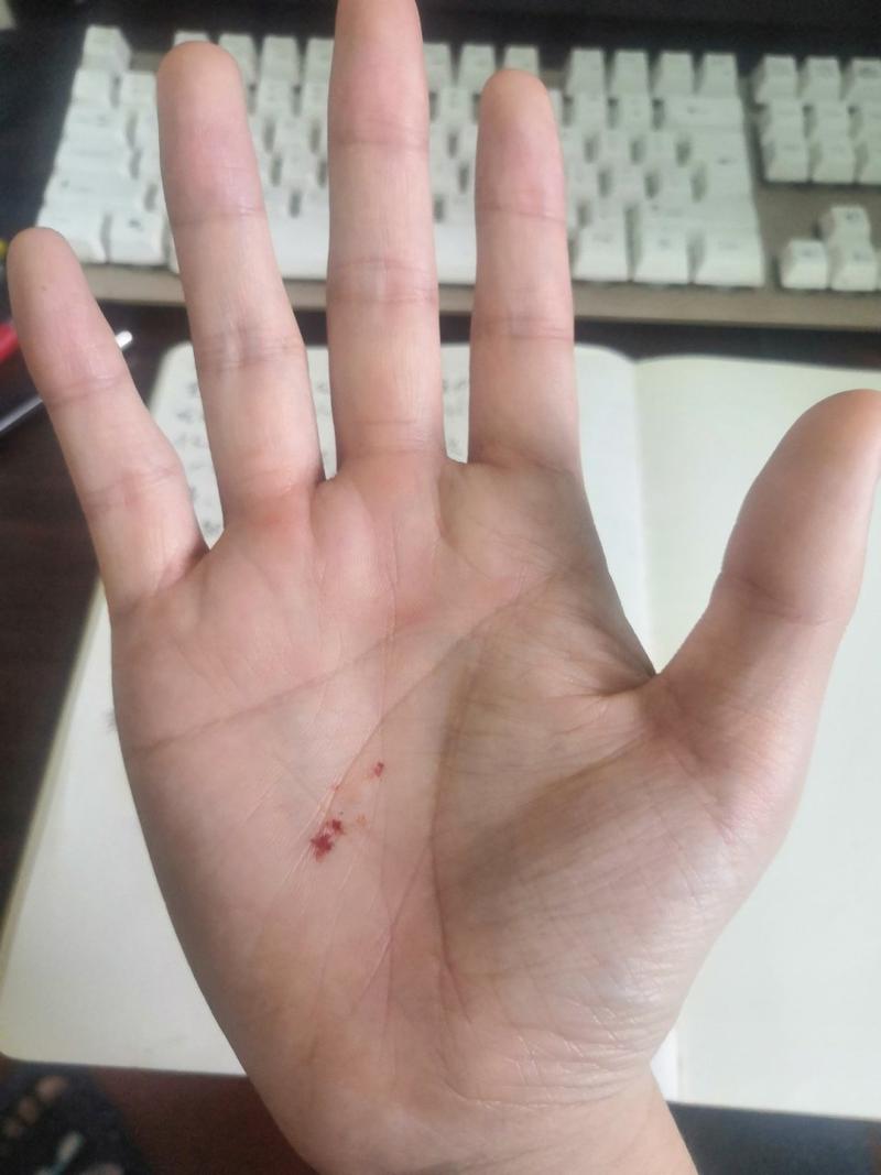 红是朱砂痣烙印胸口 红是蚊子血般平庸