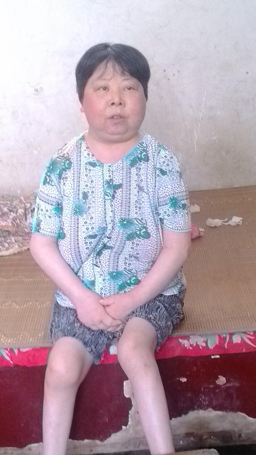 及治疗,平时靠口服激素药控制,现在已经出现严重的并发症,如满月脸,向