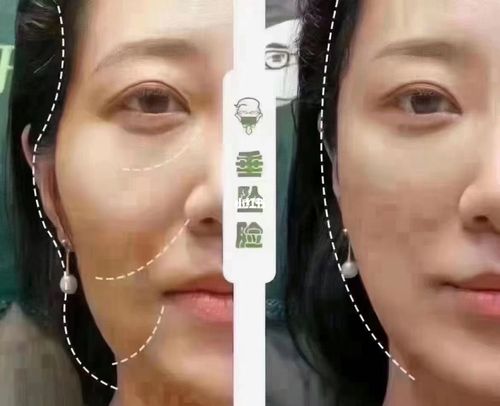 衰老_法令纹_干纹_泪沟_美妆_护肤