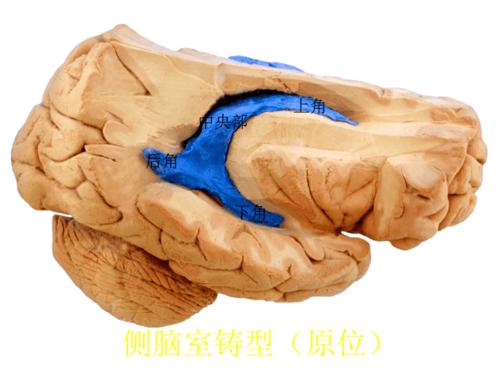 脑室,脑池应用解剖