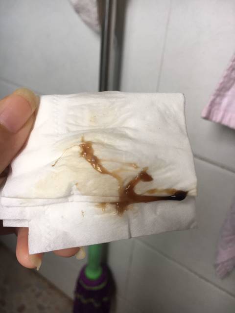 孕期宫颈息肉好烦呐