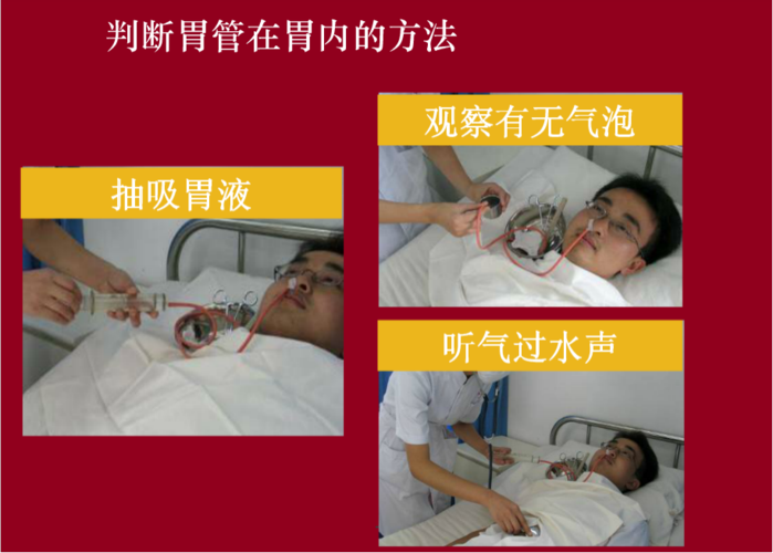 规范操作 提升能力 扎实基础——豫东医院"留置胃管操作技术"考试纪实