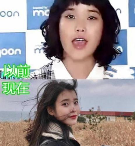 "以前有多胖, 现在有多美", iu郑爽还好, 看到泫雅: 咋做到的?