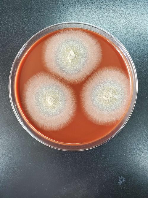 其它 1例镰刀菌感染的眼角膜溃疡 写美篇为了方便观察形态,转种血平板