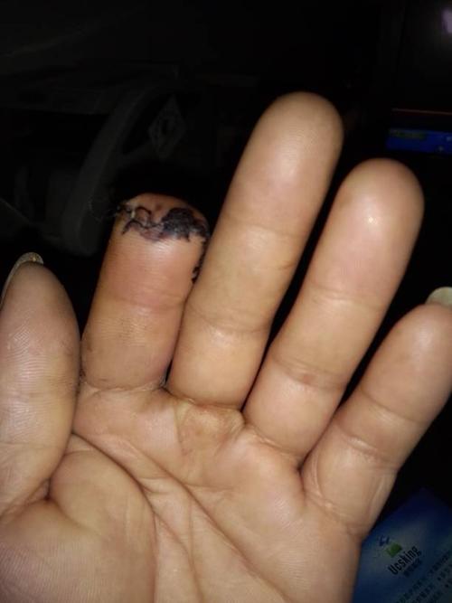 四万可以吗 回答 你百度,九级伤残鉴定 和九级伤残赔偿标准 具体要问