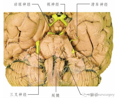 它可使小血管阻塞,老年人患有滑车神经麻痹,必需