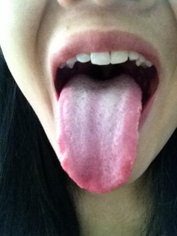 我胃热舌苔厚但脾胃虚弱吃什么药好啊要