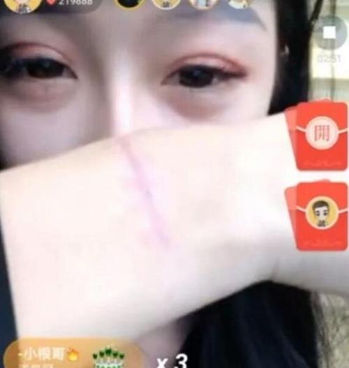 疑似几年董莹莹晒手腕伤痕声称只想自证清白