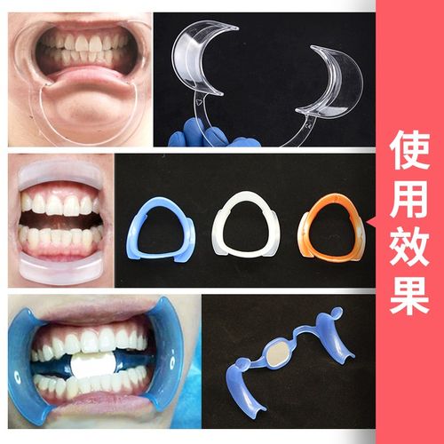 口器撑嘴张口器牙科开口口腔拉钩一次性扩嘴器牙其它口腔护理设备