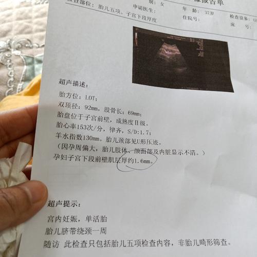 37周了医生说胎儿已入盆,就是子宫后度1.6可以顺产吗,还有