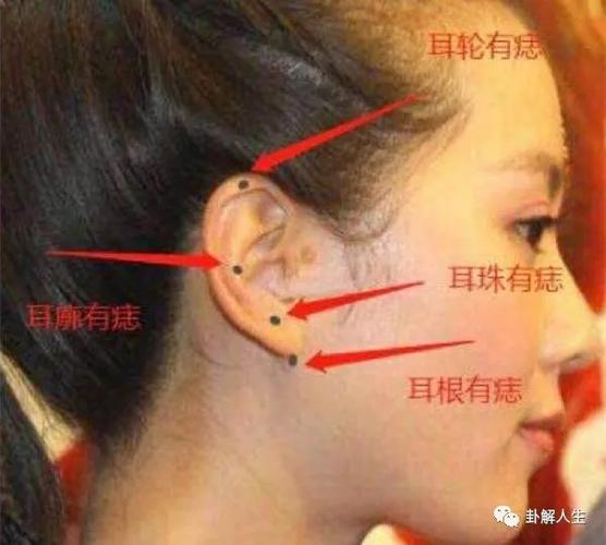 耳朵上的几颗富贵痣|主财|耳珠_网易订阅