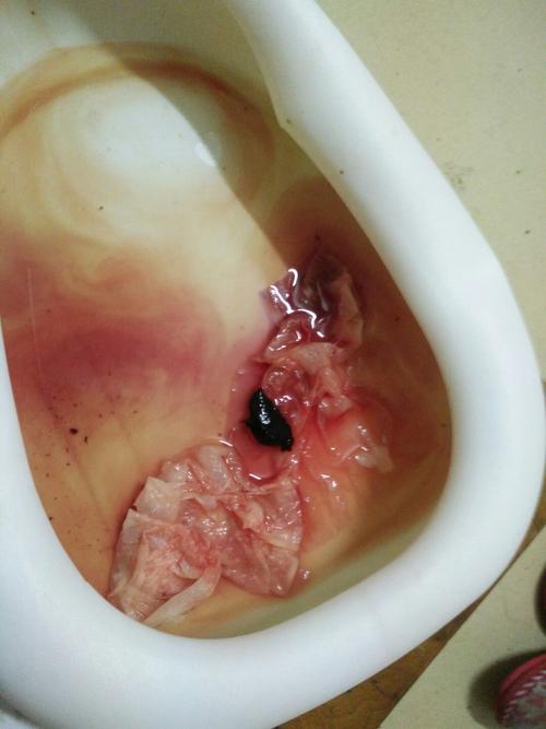 我现在是前置胎盘状态有反复出血今天出血还有黑色的血块应该怎么