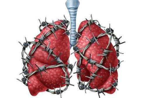 肺癌的5个不典型前兆,错过了它,肺癌肯定拖到晚期!