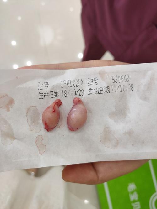 讨论那个想看看大家崽崽绝育割下来的蛋蛋图片有蛋蛋图慎入