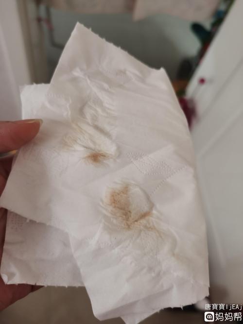 持续这样有褐色分泌物,在怀孕初期需要注意