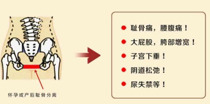 耻骨痛如何缓解孕晚期第一疼痛