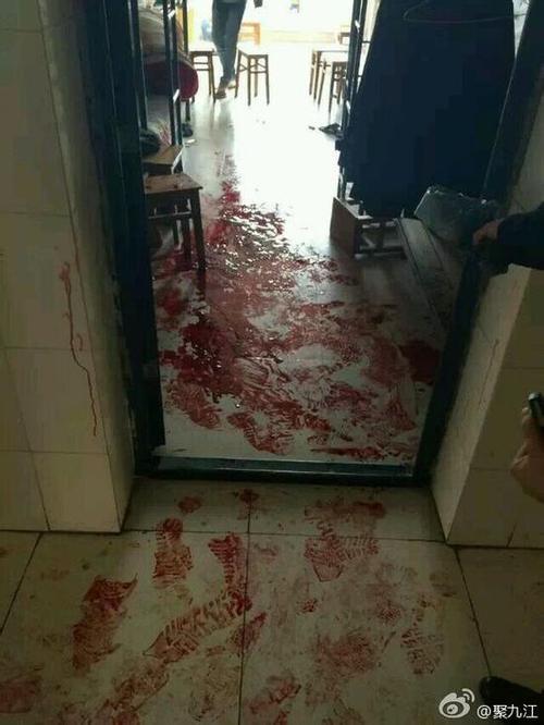 九江职业大学2名学生因琐事争执 1人被刺伤