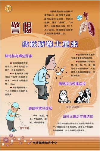 如何预防肺结核