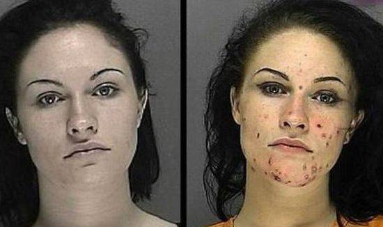 镜头下长期吸毒的女人,浑身长满脓疮外形让人情绪失控