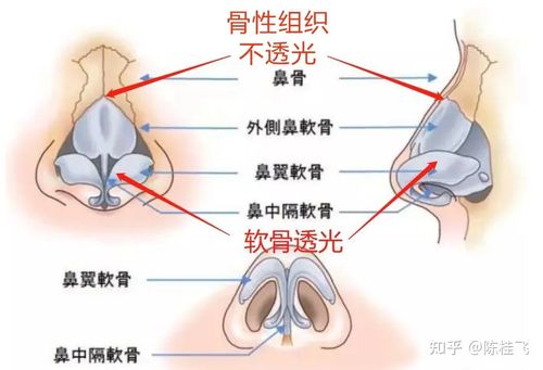 鼻部结构解剖图