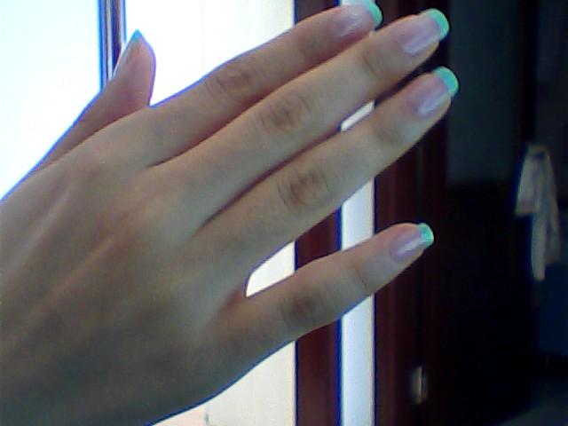 小手指中间的骨节粗是怎么回事,能治好么