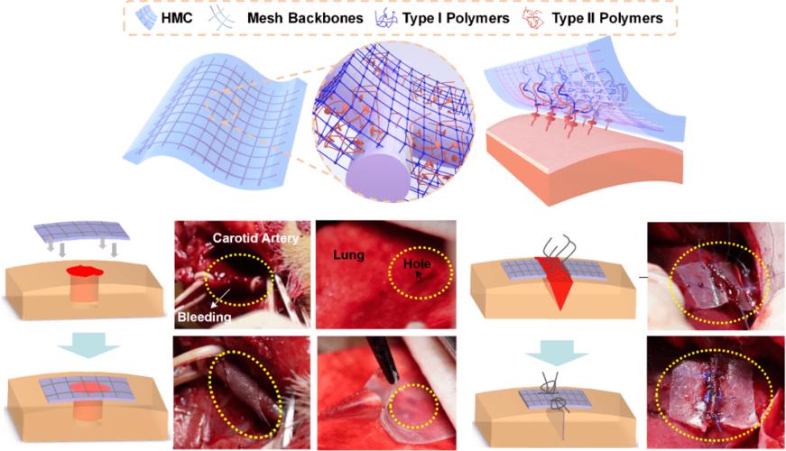 外科补片是一种广泛应用于外科手术的医用编织物,通常起到为组织器官