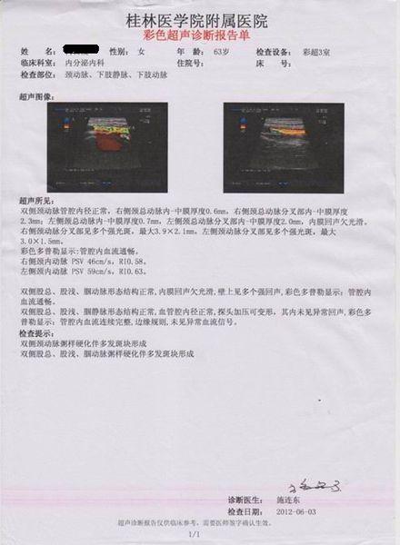 颈动脉超声是诊断,评估颈动脉壁病变的有效手段之一,在动脉粥样硬化