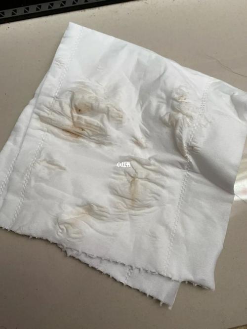 妊娠7周左右 出现一些褐色分泌物!_妊娠_孕酮_黄体酮