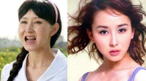 那些戴过牙套很丑的明星最后一位简直想不到啊