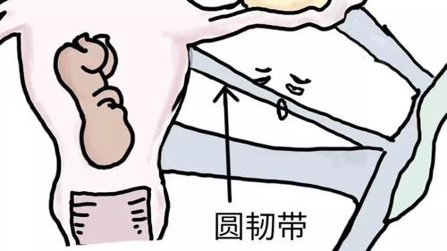 孕期生孩子那些事 之圆韧带痛