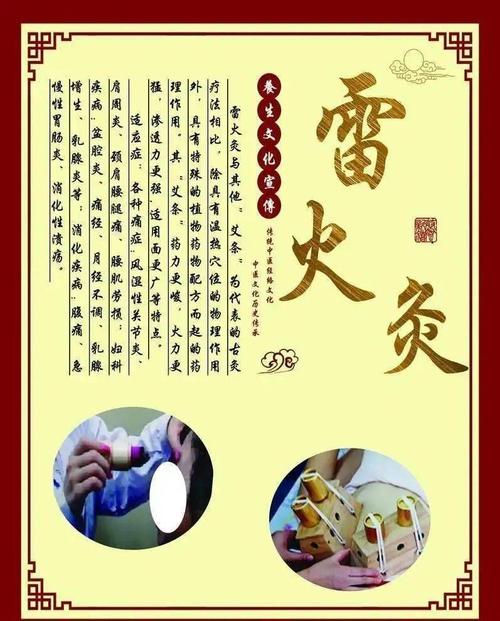 "雷火灸"_手机搜狐网