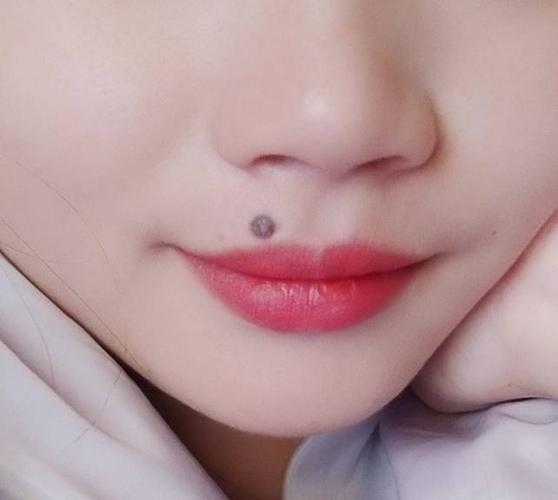 嘴巴左上有个痣,可以激光嘛,那个痣有点凸起来的,又有