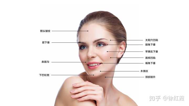 针对(额头皱纹,眉下垂,眼角下垂,太阳穴凹陷,苹果肌下垂,颧颊垫下垂
