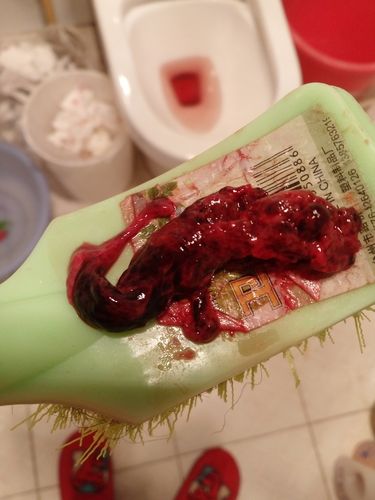 怀孕43天药流孕囊图片