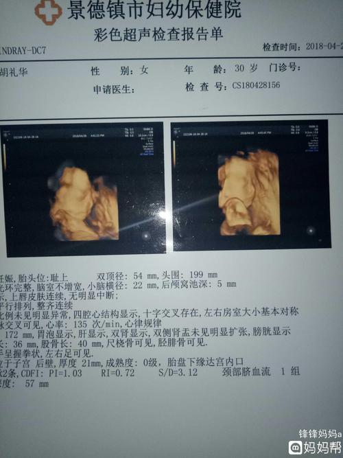 四维归来,女宝一枚,要女宝的来接,附图