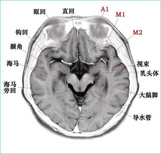 这个高清颅脑断层解剖图谱实在太棒了!【磁共振 大体标本】