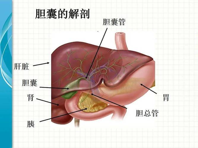 腹腔镜胆囊切除术护理查房