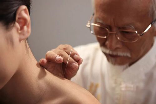 【名家针方】乳腺增生可否用针灸治疗?国医大师帮您解答!