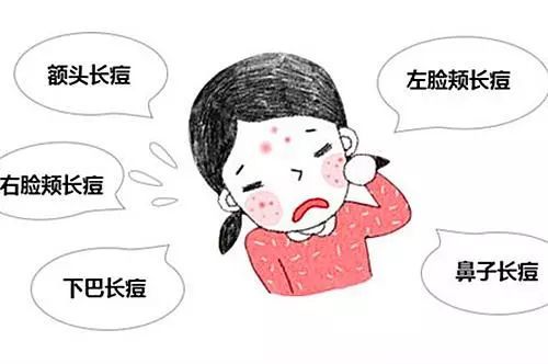 5,皮肤呈锈色,情绪抑郁,早起易便秘,肺部毒素过多;4,便秘,口臭,肤色